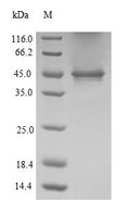 (Tris-Glycine gel) Discontinuous SDS-PAGE (reduced) with 5% enrichment gel and 15% separation gel.