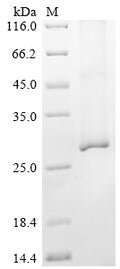 (Tris-Glycine gel) Discontinuous SDS-PAGE (reduced) with 5% enrichment gel and 15% separation gel.