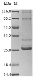 (Tris-Glycine gel) Discontinuous SDS-PAGE (reduced) with 5% enrichment gel and 15% separation gel.
