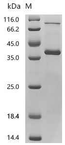 (Tris-Glycine gel) Discontinuous SDS-PAGE (reduced) with 5% enrichment gel and 15% separation gel.
