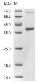 (Tris-Glycine gel) Discontinuous SDS-PAGE (reduced) with 5% enrichment gel and 15% separation gel.