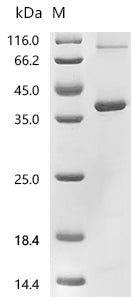 (Tris-Glycine gel) Discontinuous SDS-PAGE (reduced) with 5% enrichment gel and 15% separation gel.