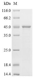 (Tris-Glycine gel) Discontinuous SDS-PAGE (reduced) with 5% enrichment gel and 15% separation gel.