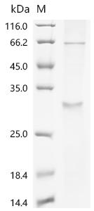 (Tris-Glycine gel) Discontinuous SDS-PAGE (reduced) with 5% enrichment gel and 15% separation gel.