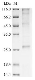 (Tris-Glycine gel) Discontinuous SDS-PAGE (reduced) with 5% enrichment gel and 15% separation gel.