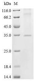 (Tris-Glycine gel) Discontinuous SDS-PAGE (reduced) with 5% enrichment gel and 15% separation gel.