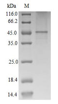 (Tris-Glycine gel) Discontinuous SDS-PAGE (reduced) with 5% enrichment gel and 15% separation gel.