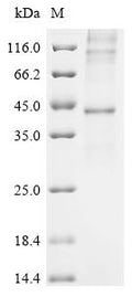 (Tris-Glycine gel) Discontinuous SDS-PAGE (reduced) with 5% enrichment gel and 15% separation gel.