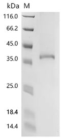 (Tris-Glycine gel) Discontinuous SDS-PAGE (reduced) with 5% enrichment gel and 15% separation gel.
