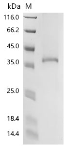 (Tris-Glycine gel) Discontinuous SDS-PAGE (reduced) with 5% enrichment gel and 15% separation gel.