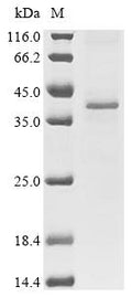 (Tris-Glycine gel) Discontinuous SDS-PAGE (reduced) with 5% enrichment gel and 15% separation gel.