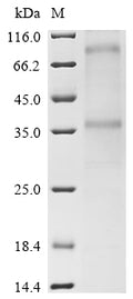 (Tris-Glycine gel) Discontinuous SDS-PAGE (reduced) with 5% enrichment gel and 15% separation gel.