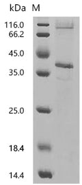 (Tris-Glycine gel) Discontinuous SDS-PAGE (reduced) with 5% enrichment gel and 15% separation gel.