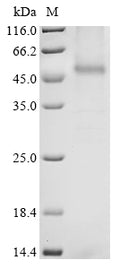 (Tris-Glycine gel) Discontinuous SDS-PAGE (reduced) with 5% enrichment gel and 15% separation gel.