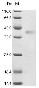 (Tris-Glycine gel) Discontinuous SDS-PAGE (reduced) with 5% enrichment gel and 15% separation gel.