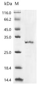 (Tris-Glycine gel) Discontinuous SDS-PAGE (reduced) with 5% enrichment gel and 15% separation gel.