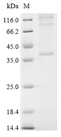 (Tris-Glycine gel) Discontinuous SDS-PAGE (reduced) with 5% enrichment gel and 15% separation gel.