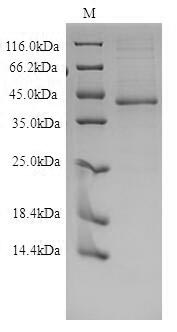 (Tris-Glycine gel) Discontinuous SDS-PAGE (reduced) with 5% enrichment gel and 15% separation gel.