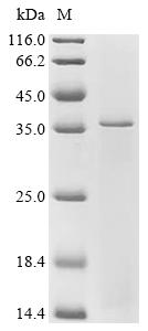 (Tris-Glycine gel) Discontinuous SDS-PAGE (reduced) with 5% enrichment gel and 15% separation gel.