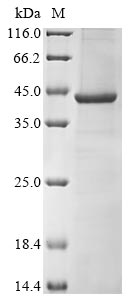 (Tris-Glycine gel) Discontinuous SDS-PAGE (reduced) with 5% enrichment gel and 15% separation gel.