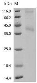 (Tris-Glycine gel) Discontinuous SDS-PAGE (reduced) with 5% enrichment gel and 15% separation gel.