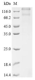 (Tris-Glycine gel) Discontinuous SDS-PAGE (reduced) with 5% enrichment gel and 15% separation gel.