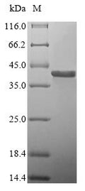 (Tris-Glycine gel) Discontinuous SDS-PAGE (reduced) with 5% enrichment gel and 15% separation gel.