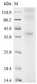 (Tris-Glycine gel) Discontinuous SDS-PAGE (reduced) with 5% enrichment gel and 15% separation gel.