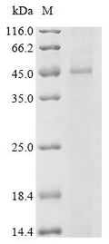 (Tris-Glycine gel) Discontinuous SDS-PAGE (reduced) with 5% enrichment gel and 15% separation gel.