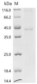 (Tris-Glycine gel) Discontinuous SDS-PAGE (reduced) with 5% enrichment gel and 15% separation gel.