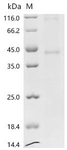 (Tris-Glycine gel) Discontinuous SDS-PAGE (reduced) with 5% enrichment gel and 15% separation gel.