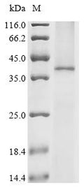 (Tris-Glycine gel) Discontinuous SDS-PAGE (reduced) with 5% enrichment gel and 15% separation gel.