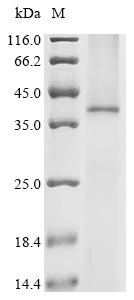 (Tris-Glycine gel) Discontinuous SDS-PAGE (reduced) with 5% enrichment gel and 15% separation gel.