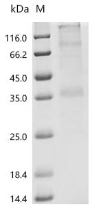 (Tris-Glycine gel) Discontinuous SDS-PAGE (reduced) with 5% enrichment gel and 15% separation gel.