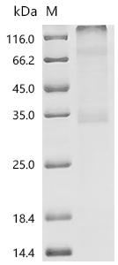(Tris-Glycine gel) Discontinuous SDS-PAGE (reduced) with 5% enrichment gel and 15% separation gel.