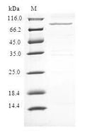 (Tris-Glycine gel) Discontinuous SDS-PAGE (reduced) with 5% enrichment gel and 15% separation gel.
