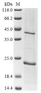 (Tris-Glycine gel) Discontinuous SDS-PAGE (reduced) with 5% enrichment gel and 15% separation gel.