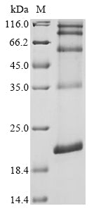 (Tris-Glycine gel) Discontinuous SDS-PAGE (reduced) with 5% enrichment gel and 15% separation gel.
