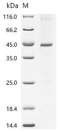 (Tris-Glycine gel) Discontinuous SDS-PAGE (reduced) with 5% enrichment gel and 15% separation gel.
