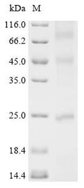 (Tris-Glycine gel) Discontinuous SDS-PAGE (reduced) with 5% enrichment gel and 15% separation gel.