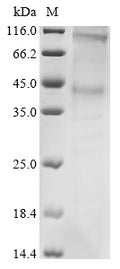 (Tris-Glycine gel) Discontinuous SDS-PAGE (reduced) with 5% enrichment gel and 15% separation gel.