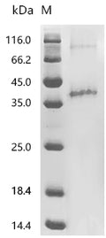 (Tris-Glycine gel) Discontinuous SDS-PAGE (reduced) with 5% enrichment gel and 15% separation gel.