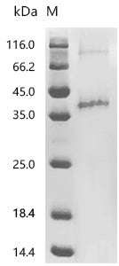 (Tris-Glycine gel) Discontinuous SDS-PAGE (reduced) with 5% enrichment gel and 15% separation gel.