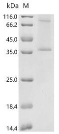 (Tris-Glycine gel) Discontinuous SDS-PAGE (reduced) with 5% enrichment gel and 15% separation gel.