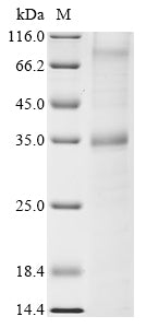 (Tris-Glycine gel) Discontinuous SDS-PAGE (reduced) with 5% enrichment gel and 15% separation gel.