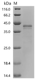 (Tris-Glycine gel) Discontinuous SDS-PAGE (reduced) with 5% enrichment gel and 15% separation gel.