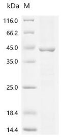 (Tris-Glycine gel) Discontinuous SDS-PAGE (reduced) with 5% enrichment gel and 15% separation gel.