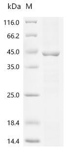 (Tris-Glycine gel) Discontinuous SDS-PAGE (reduced) with 5% enrichment gel and 15% separation gel.