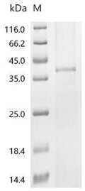 (Tris-Glycine gel) Discontinuous SDS-PAGE (reduced) with 5% enrichment gel and 15% separation gel.