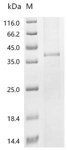 (Tris-Glycine gel) Discontinuous SDS-PAGE (reduced) with 5% enrichment gel and 15% separation gel.